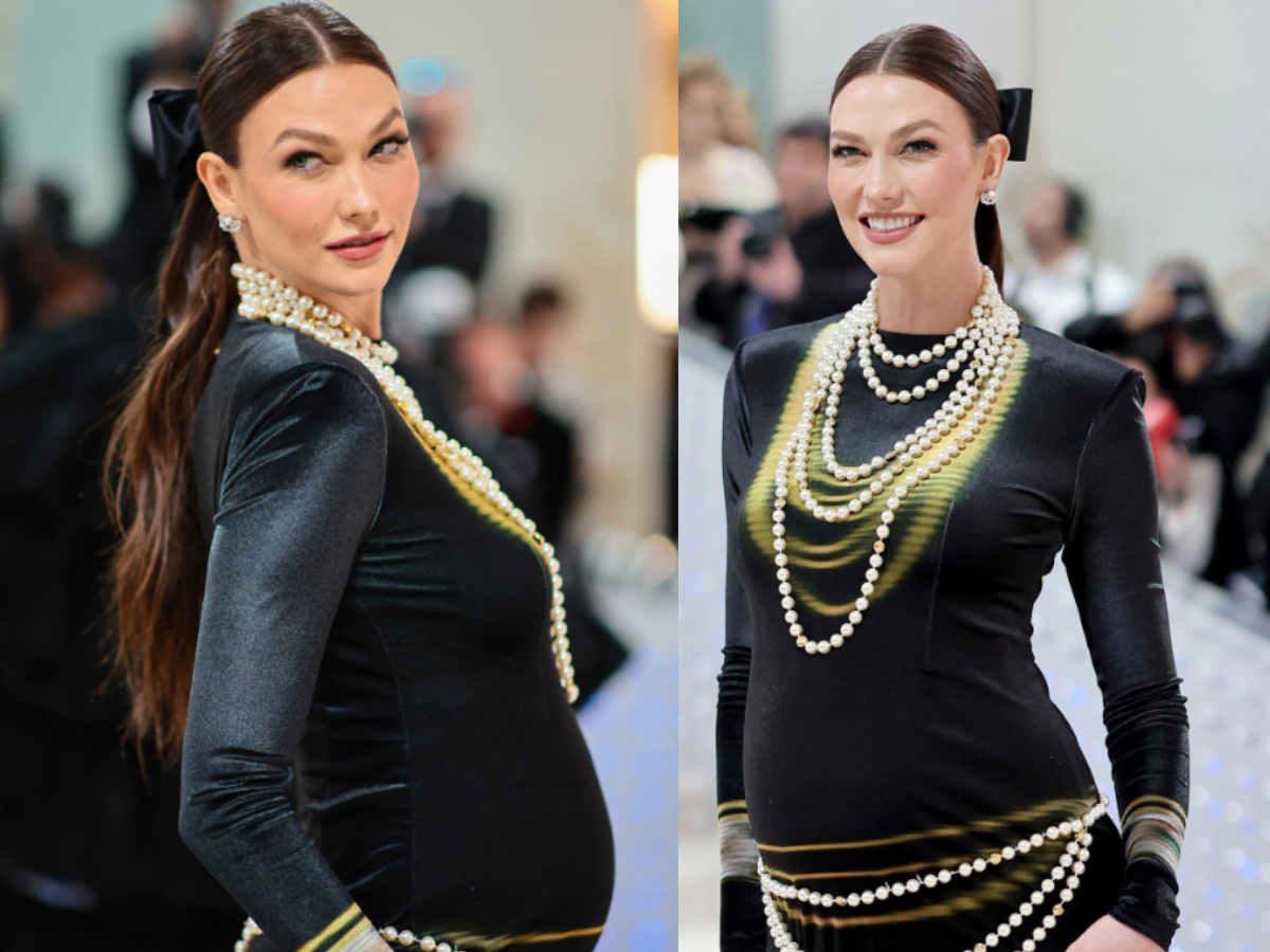 Karlie Kloss