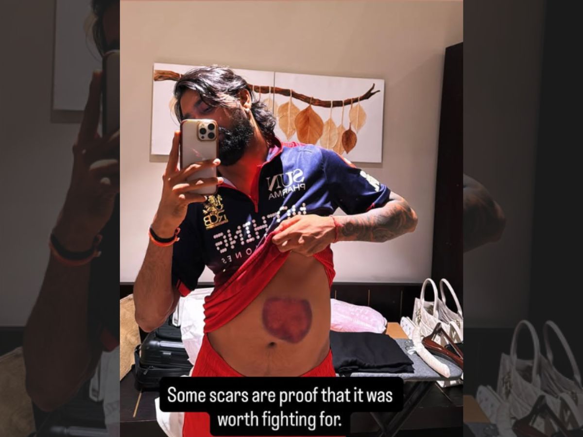 ipl-2026-krunal-pandya-shares-bruised-stomach-selfie-after-match-winning-knock-against-former-team-mumbai-indians-in-raipur Krunal Pandya Image Credit: Instagram